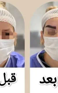 تخفیف شگفت انگیز کاشت ابروی بهاری