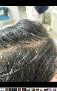 اسکراب تخصصی کف ،سرخداحافظی با چربی و شوره