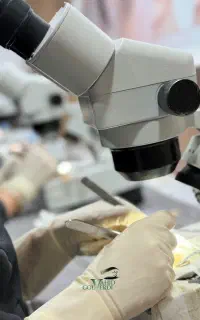 استخدام کات کار کاشت ابرو در اتاق عمل