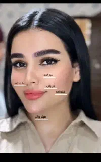 تزریق ژل وبوتاکس فیلر بادی100تومن ولیعصراناطب