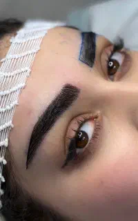 کاشت مو و ابرو  مشاوره و تعیین هزینه