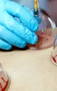 حجامت