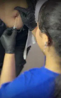 دوره حضوری چال گونه و پرسینگ بادی و میکرودرمال999