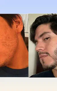 بلیت کنسرت ریشو ها