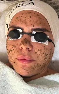 فیشال تخصصی ،ماساژ ، و اسکالپ مو