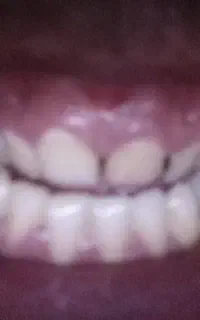 کد دعوت رد بانک جشنواره جدید