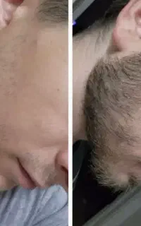 ریش نداری، کلیک کن