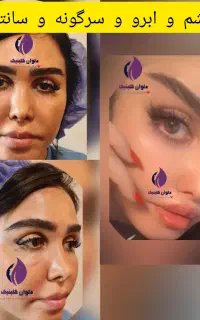 جشنواره عیدانه پلک.شقیقه.ابرو.سانترال لب.