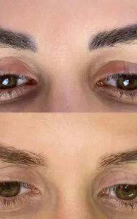 ریمور تاتو