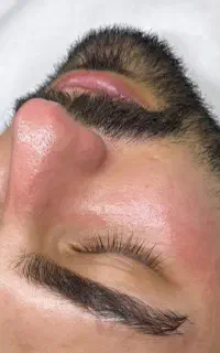 فیشیال و خدمات پوستی برای آقایان
