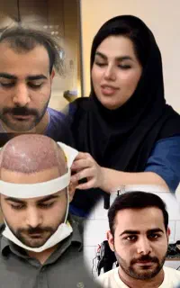 کاشت فول تراکم کل سر،نقد و ‌اقساط (خانم‌بهروزی)