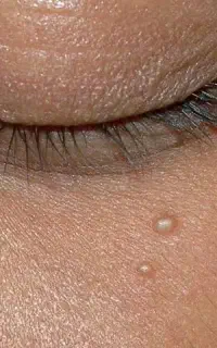 پاکسازی دانه میلیا