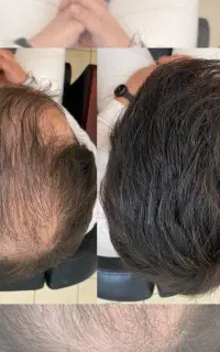 بدون خون و‌خونریزی ی کاری کن موهات دربیاد