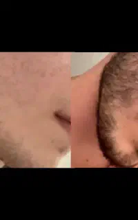 معجزه ریشات