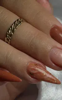 کاشت ناخن