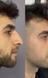 از یه تار تا ده تار