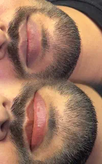 اصلاح تیرگی لب آقایان با نتیجه طبیعی