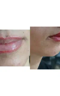 نیاز به مدل تتو صورت