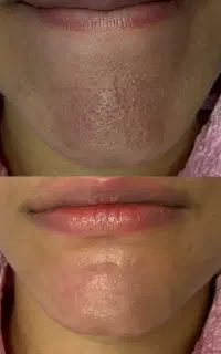 پوست خانم ها و آقایان