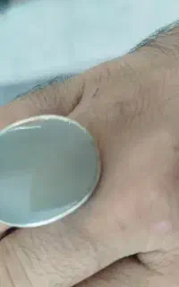 حلقه