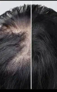 بازگشت اعتماد به نفس در هر تار مو