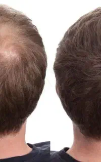 تارهای ظریف رو قوی‌تر کن