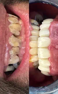 خدمات درمانی و زیبایی دندانپزشکی