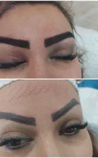کلینیک مجوزدار کاشت ابرو در قم