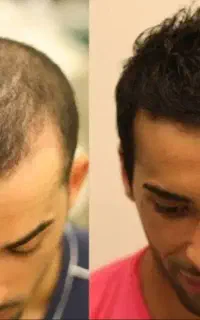 موهای پرپشت، حس بهتر