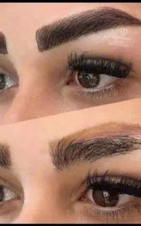 فیبروز،میکرونچرال وآموزش اصولی 4متدجهانی (تضمینی)