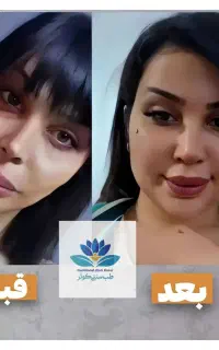 تپل شو