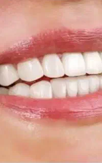 عصب ‌کشی دندان‌های قدامی