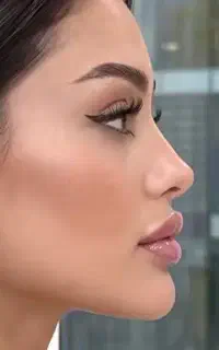 جشنواره ژل لب بیکینی سینه بوتاکس میکرونیدلینگ