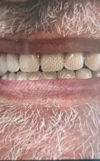 دندانسازی معروف محلات