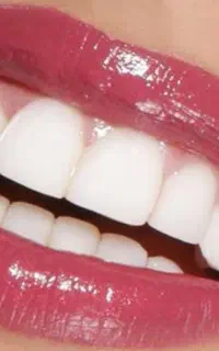 خدمات دندانپزشکی و ایمپلنت با تخفیف ویژه
