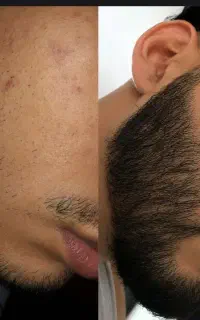 زیبایی را با ما بدستش بیار
