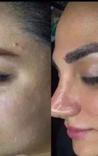 فشیال تخصصی ودرمانی واسکالپ سر۵۰ درصدتخفیف