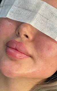 انجام زیبایی **صورت **