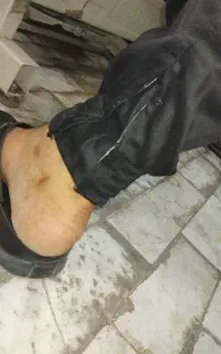 شلوار مشاوره دمپا زیپ