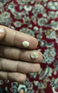 نگین نر ماده