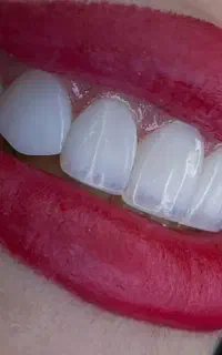 جشنواره دندانپزشکی با بالاترین کیفیت