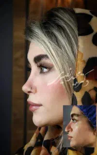 جوانسازی صورت با اقساط ویژه بدون پیش پرداخت