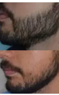 رویش کامل ریشات با ما