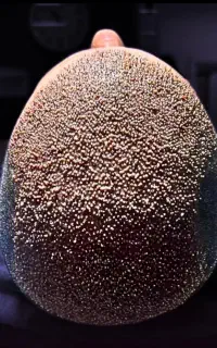 کاشت موی طبیعی
