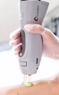 لیزر موهای زائد با جوابدهی تضمینی