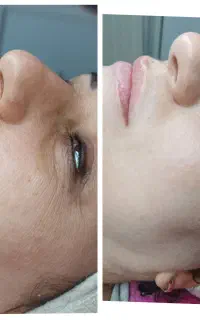 فیشیال VIP پوست  اسکالپ تخصصی سر  آموزش با مدرک