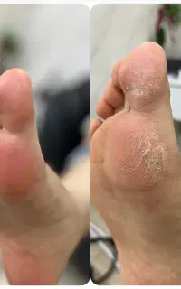 پدیکور کفسابی کف پا