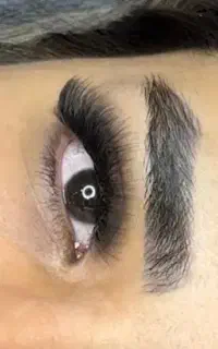 کاشت مژه