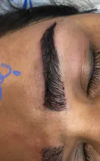 میکروکاشت ابرو بدون بخیه با جدیدترین روش