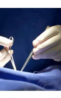 دکتر زنان وتخصص جراحی لابیا پلاستی